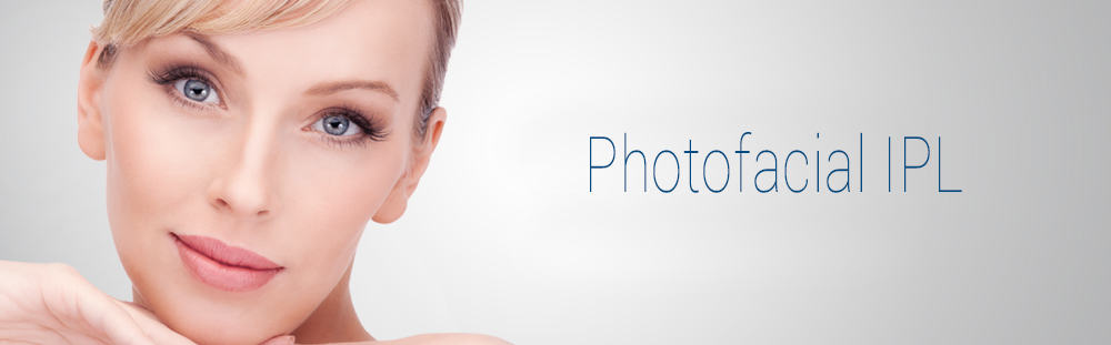 Photofacial IPL