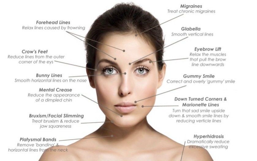 botox xeomin dysport skin